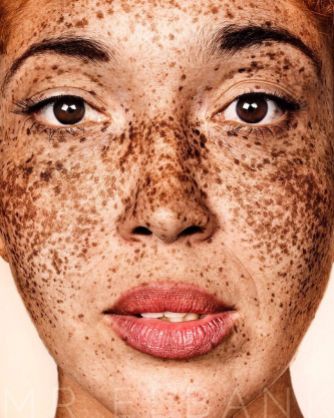 The-beauty-of-the-freckles-by-the-photographer-Brock-Elbank-5a829b946c076__700