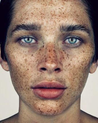 The-beauty-of-the-freckles-by-the-photographer-Brock-Elbank-5a829b97aa41b__700