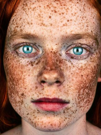 The-beauty-of-the-freckles-by-the-photographer-Brock-Elbank-5a829b9e1c7d9__700