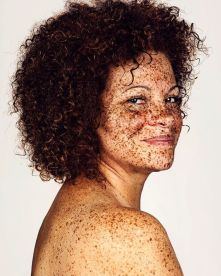 The-beauty-of-the-freckles-by-the-photographer-Brock-Elbank-5a829dfd63f01__700